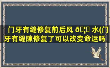门牙有缝修复前后风 🦊 水(门牙有缝隙修复了可以改变命运吗 🌸 )